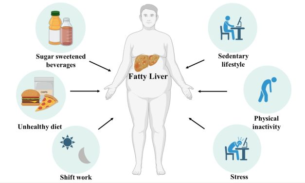 Prolonged sitting, long working hours, shift work and stress among IT employees in India affects Metabolism and Liver Health